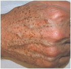 ipl-hands1