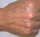 ipl-hands22